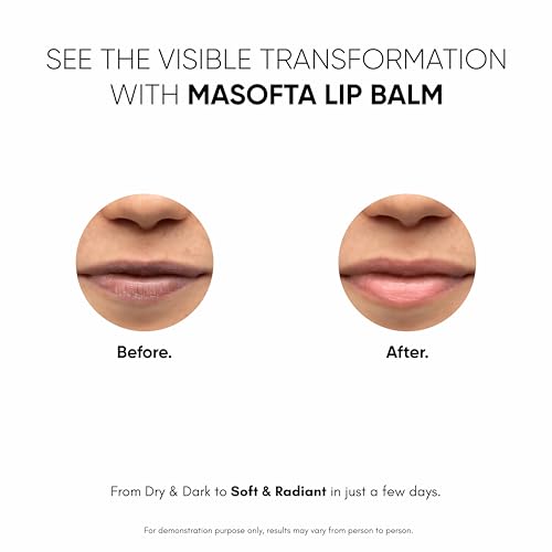 Masofta Shea Butter Lip Balm with Kojic Acid, Alpha Arbutin & Shea Butter for Smooth, Crack Free & Clear Lips, SPF 30 PA++, For Men & Women, 0.52 oz/15GMS