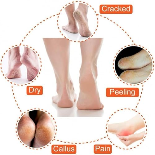 Image of Concepta Crack Cotton Foot Protector Moisturizing Socks with Spa Gel, Heel Pain Relief Silicone Gel Pad Heel Protector Socks with Spa Botanical for Men and Women Cotton Socks Multicolour (Pack of 3 Pair)