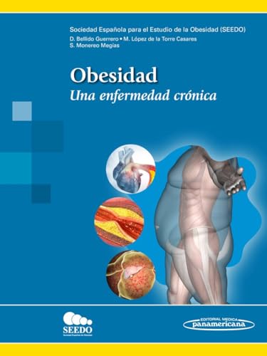 Obesidad (+ e-book): Una enfermedad crónica Obesidad (+ e-book): Una enfermedad crónica