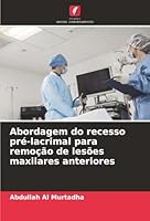 Abordagem do recesso pré-lacrimal para remoção de lesões maxilares anteriores (Portuguese Edition) 6208960908 Book Cover