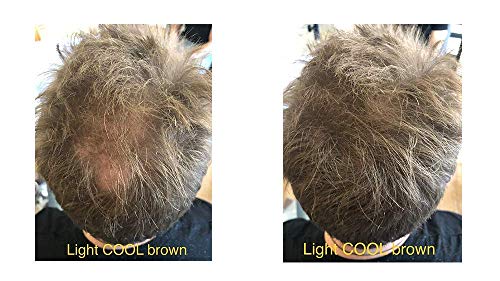 FEBRON Hair Building Fibers - Hair Loss Concealer For Thinning Hair - Giant 30gm Hair Powder Volumizing Based (Light COOL Brown)