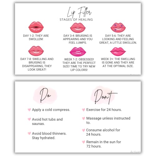 Lip Filler Aftercare Instructions Cards | 50 Pack | 2x3.5 Inch | Business Card Size | Hyaluronic Pen for Spa Esthetician | LEES A.M.