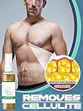Mnbhe 2PCS 30ml Gynecomastia Cellulite Melting Spray, Gynecomastia Reduction Cellulite Spray, Losing...