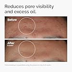 The Ordinary Niacinamide 10% + Zinc 1%, Smoothing Serum for Blemish-Prone Skin - Image 2