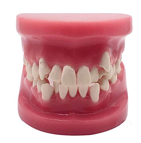 Modèle Orthodontique De Dents Adultes, Modèle Standard De Dents, Modèle Standard D'Étude Et D'Enseignement des Soins Dentaires pour l'enseignement en Laboratoir,Red