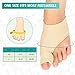 Bunion Corrector,1 Pair Premium Gel Bunion Pads Hallux Valgus Corrector No Surgery Medical Grade Bunions Splint for Bunion Relief Bunion Socks
