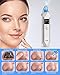 EUASOO Blackhead Remover Vacuum Facial Pore Cleanser Electric Acne Comedone Extractor Kit USB Rechargeable Blackhead Suction Tool with 3 Skin Repair Lamps, 5 Probes, 5 Suction Power for Skin Treatment