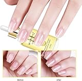 2Pcs Organic Vitamin E & B Nail Cuticle Oil – Infused with Jojoba to Moisturize & Strengthen Nails, Prevent Hangnails & Chapped Skin. Promotes Healthy Cuticles & Nail Growth. 15ML - Image 5