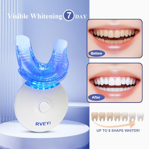 Image of Teeth Whitening Kit with 5 LED Light, 35% Carbamide Peroxide Gel Syringes+1 Desensitizing Gel, Timer Teeth Whitening Light Frendly for Sensitive Teeth