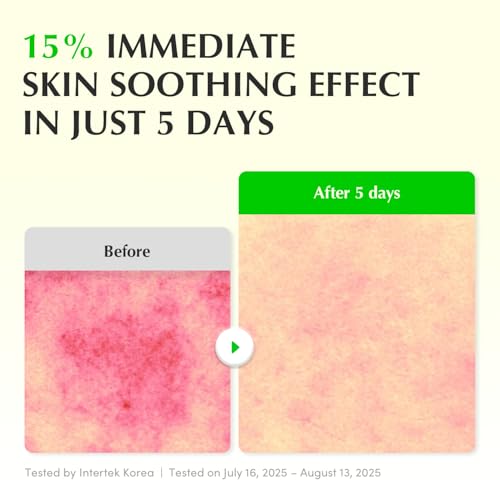 Image of EQQUALBERRY Aloe PDRN Calming Smoothie Serum - Soothing Korean Skin Care for Sensitive Skin, Cica & Aloe for Repair, Hydrating & Radiant Glow, Non-Comedogenic (1.01oz / 30ml)