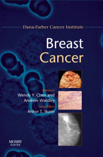 Breast Cancer (Dana-Farber Cancer Institute Handbooks S.)