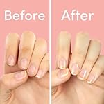 ella+mila "First Aid Kiss" Nail Strengthener and Growth treatment- Nail Repair Solution & Growth Treatment for Thin, Brittle & Damaged Nails - Nail Hardener with Vitamin E (0.45 fl oz) - Image 4