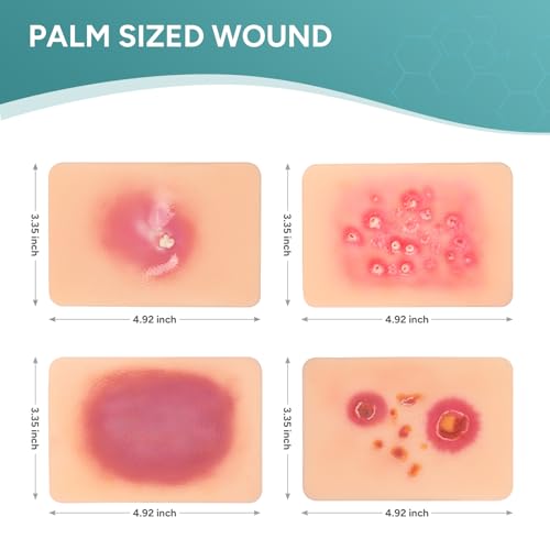 Image of Bacterial Infected Wound Model for Medical Education | Wound Packing Trainer, Palm Sized Wound Simulation Models, Wound Care Demonstrations Tool, 4PCS