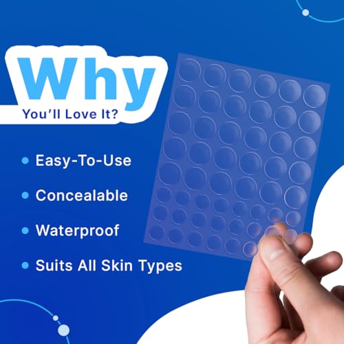 Image of Sotrue Acne Pimple Patches For Face | For Active Surface Acne | Hydrocolloid Waterproof Patches | Absorbs Pimple Overnight, Reduces Excess Oil | Suits All Skin Types (54 Patches)