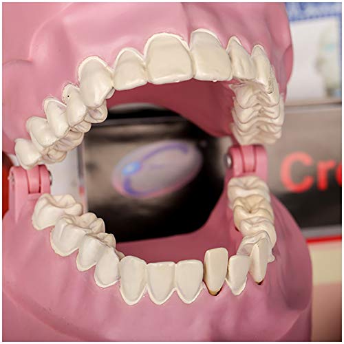 Modèle D'Anatomie Dentaire pour L'Étude des Dents - Modèle De Dent Dentaire - Kit Pédagogique De Biologie Dentaire - Modèle De Stomatologie pour Enfants Et Étud