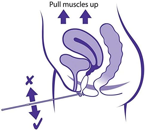 Neen Periform+ Intra-Vaginal Probe - Image 3