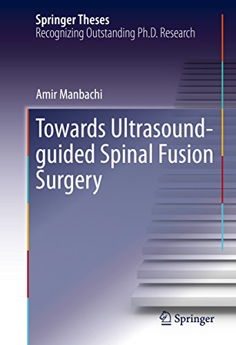 Towards Ultrasound-guided Spinal Fusion Surgery (Springer Theses) (English Edition)