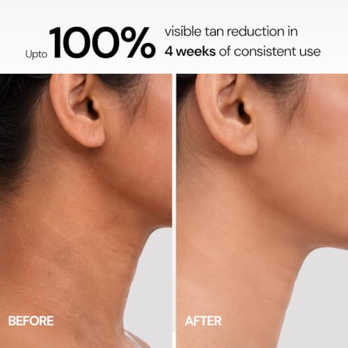 Image of Detan Brightening Body Wash with 8.25% Active Blend | Kojic Acid, Niacinamide, Alpha Arbutin, Salicylic Acid & Charcoal | Tan Removal, Skin Brightening, Dark Spot, Underarm & Body Pigmentation Wash for Women, Men, Boys, Girls & Teens | Sulphate Free | 400ml