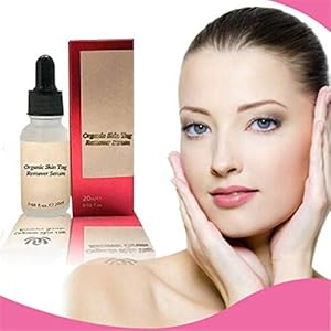 Organic Tags Solutions Serum, Skin Tag Removal Serum, Mole Remover Liquid, Skin Tag Cream, Veilig en Effectief (1 stuks)