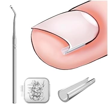 BEZOX Set correttore per unghie incarnite - 40 pezzi Strisce raddrizzanti per unghie incarnite senza dolore con sollevatore per unghie - Kit di strumenti per unghie incarnite facili da usare