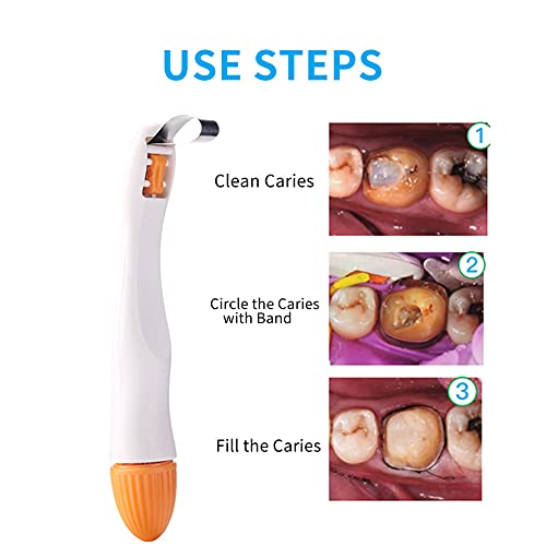 Dental Matrix Band, 50Pcs Momar Restoration Matrix-Profecto Sectional Matrix Ring System Adjust (4.5Mm-Standard) #TOP3