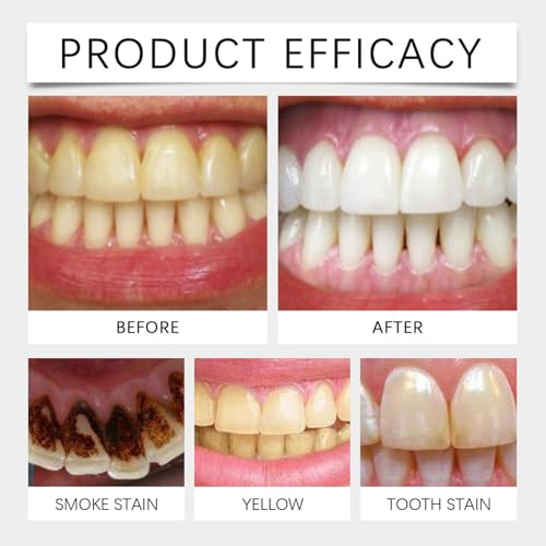 2 Stück Sp-8 Probiotische Zahnpasta, Probiotische Zahnpasta Sp8 Aufhellend, Zahnpasta SP-8 Ultra Whitening, Zahnpasta für die Tiefenreinigung, Reinigung und Tiefenpflege der Zähne – Bild 5