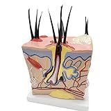 SXTYFBB Modèle Anatomique de Peau de Chien Malade, modèle Anatomique de Peau de Chien Malade agrandi 1000 Fois, Peau de Chien morbide, modèle de Peau Normale, Anatomie pour démonstration médicale