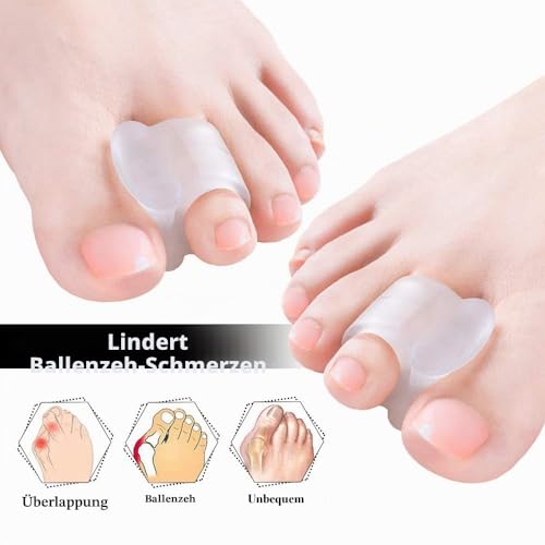 Welnove Zehenstrecker, 10x Gel Zehenspreizer für Bunion Korrektur, überlappende Zehen (Transparente Silikon Zehentrenner)