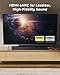 ULTIMEA 5.1CH Surround Sound Bar with Subwoofer, Dolby Atmos, VoiceMX, BassMX, APP, 300W Soundbar for Smart TV, Home Theater Surround Sound System for TV, BT 5.4, Poseidon M60 (2025 Model)