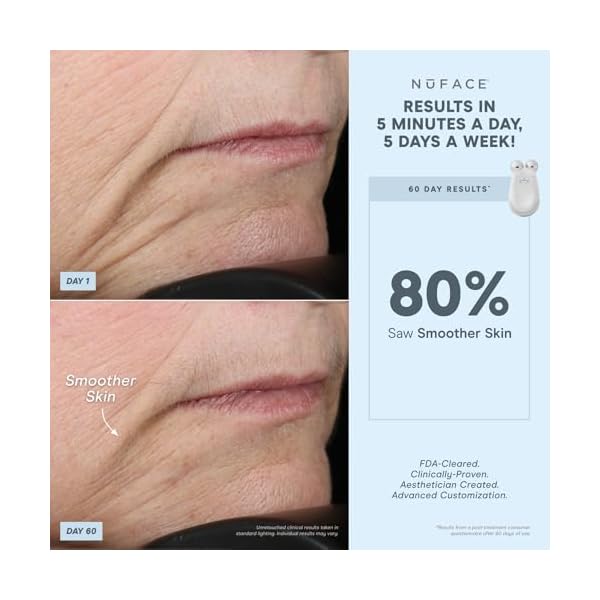 NuFACE Trinity FDA Cleared Microcurrent Facial Device & Wrinkle Reducer Attachment - Microcurrent Device with LED Red Light Attachment - Face Sculpting & Neck Tightening Device + Aqua Microcurrent Gel - Image 3