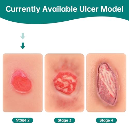 Image of Pressure Ulcer Wound Model Stage 2 Pocket Size, Pressure Injury Wound Packing Trainer for Medical Education, Decubitus Ulcer Wound Care Demonstrations Tool
