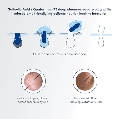 Image of Becalm Daily Salicylic Acid Face Wash for Oily and Acne Prone Skin | Airy face wash for Men & Women | Soap & Sulphate free | Oil, Acne, Dullness, Pore control | Microbiome friendly | With Quaternium - 73 & Prebiotic | No fragrance