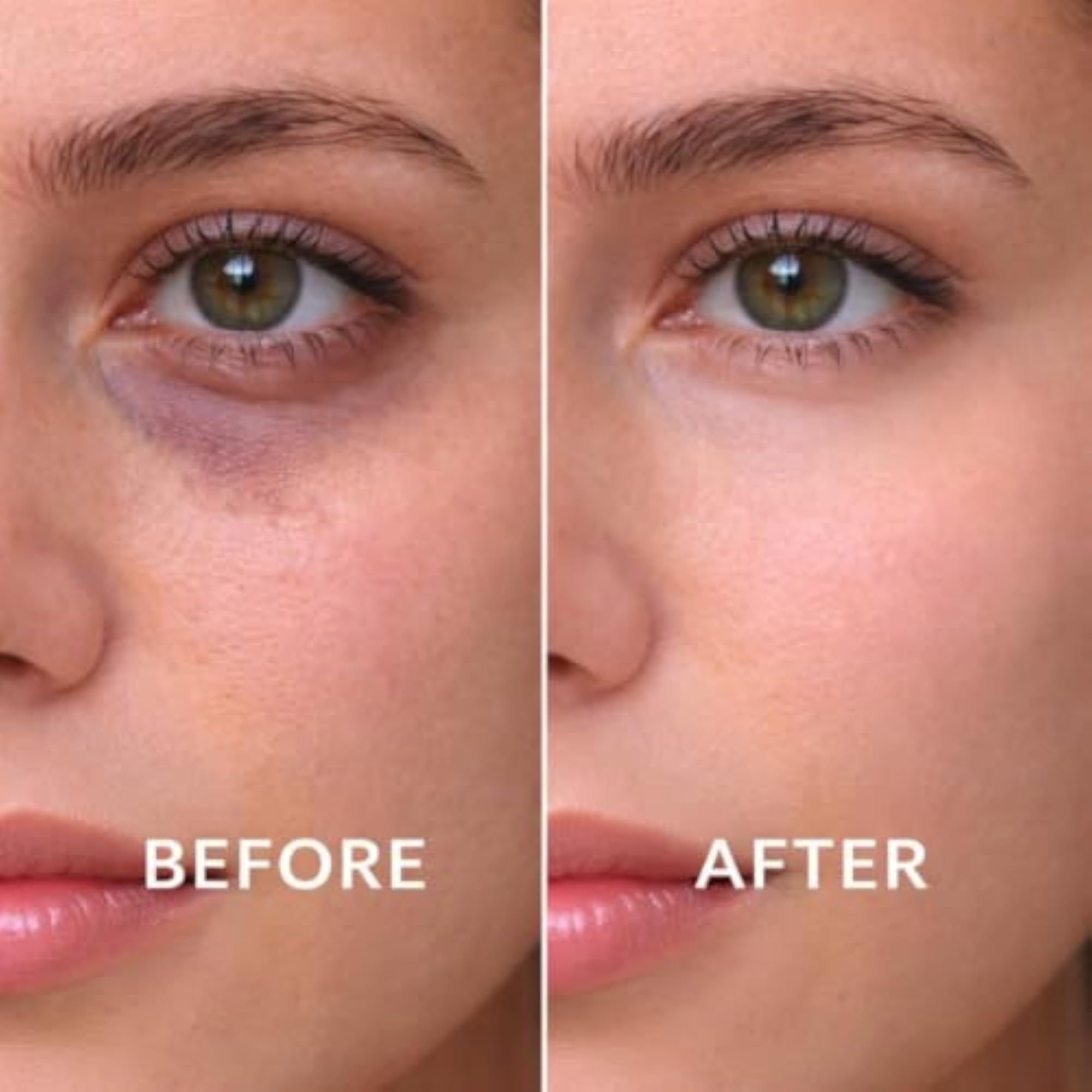 Under Eye Brightener Roller for Dark Circles