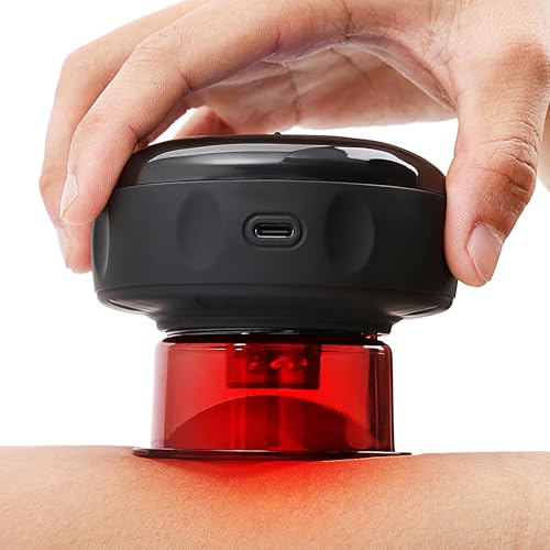UOTT 20 Levels Cupping Kit for Massage, Smart Dynamic Cupping Set
