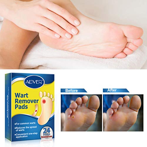 ARTIBETTER 24Pcs Verruga Removedor Removedor de Manchas Medicamentosos E Esconder a Verruga Plantar