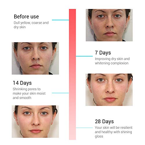 Breylee BREYLEE-QD17 Rose Face Serum, Hydrating Serum Moisturizing Serum Face Serum Hydrating With Hyaluronic Acid Alcohol Free Facial Serum thumb #5