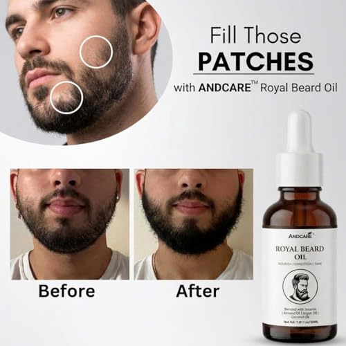 Image of Beard Oil for Men 30ml | Beard Growth for Patchy Beard No Itching & Dandruff, Thicker & Longer Beard | Non Sticky and Non Greasy Moustache Oil | All Beard Types