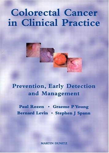 Colorectal Cancer in Clinical Practice Colorectal Cancer in Clinical Practice