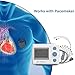 Wellue Electrocardiografo Portatil Imagen de Wellue Electrocardiografo Portatil