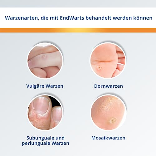 Warzenstift Endwarts PEN zur effektiven Warzenbehandlung mit Ameisensäure