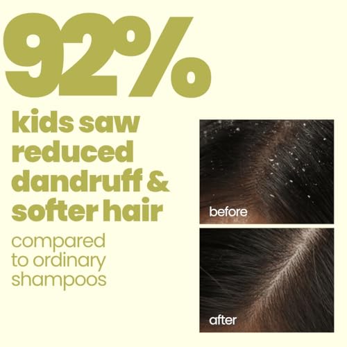 Image of TuCo Kids Flake Fighter Anti Dandruff Shampoo | Dry & Itchy Scalp | Paraben & SLS Free |100ml (pack of 1)
