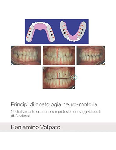 Principi di gnatologia neuro-motoria: Nel trattamento ortodontico e protesico dei soggetti adulti disfunzionali