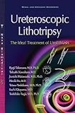 Uretroscopic Lithotripsy: The Ideal Treatment of Urolithiasis (Renal and Urologic Disorders)