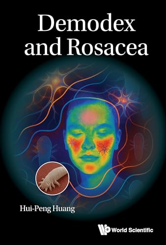 Demodex and Rosacea