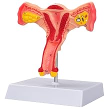 SimCoach Human Uterus and Ovary Anatomical Model, Female Reproductive Model for Medical Education, Gynecological Teaching Tool for Science Classroom & Training Demonstrations