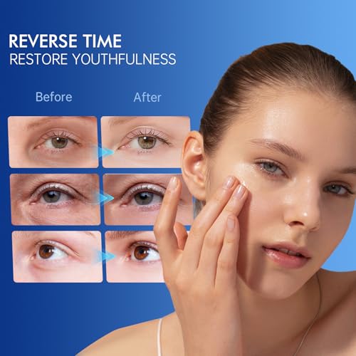 OIDLA 6% Caffeine Eye Cream for Dark Circles - Rapid Wrinkle Repair, Daily 1% Retinol & Hyaluronic Acid to Fight Fine Lines, Wrinkles, & Dark Spots, Eye Care Suitable for Men and Women's 0.68 fl. oz