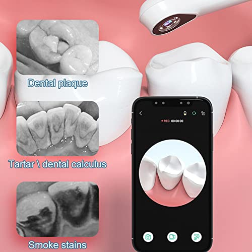 Endoscópio dental, conectar telefone com câmera oral para uso doméstico