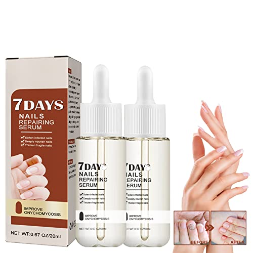 2Pcs Nail Growth Treatment,Recuperative Nail Repairing Serum,7 Days Nail Growth And Strengthening Serum,Nail Cuticle Oil Strengthener,Nail Repair Solution For Damaged Nails #TOP12