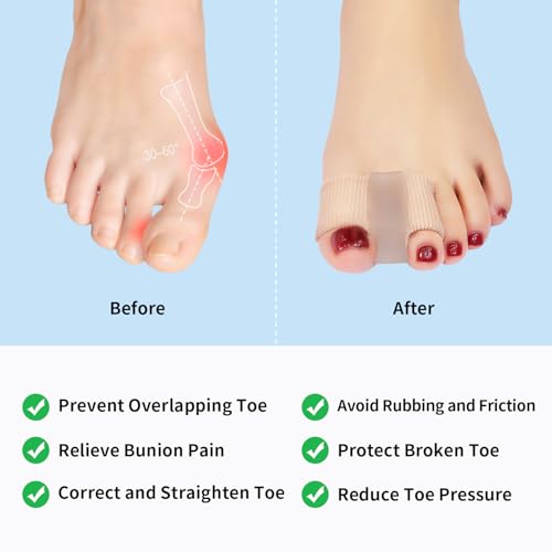 Image of Niupiour Bunion Toe Corrector W /Fabric Lining for Women and Men, Gel Toe Spacers /Separator for Overlapping, Breathable Hammer Toe Straightener with 2 Loops for Feet, Relieve Bunion Foot Pain
