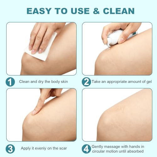 BESTEK Scar Cream, Advance Scar Gel for Surgical Scars,Face,Body,Leg, Burns, Acene,C-Section, Stretch Marks, Keloids,Scar Treatments for Old & New Scars,Scar Removal for Women Men,1.76oz/50ml